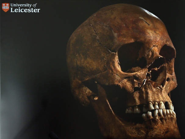 Make No Bones About It! Scientists Identify King Richard III's Skeletal Remains