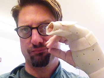 Break a…Hand? Christopher Sieber Delays His Debut as Miss Trunchbull in Matilda Due to Rehearsal Injury