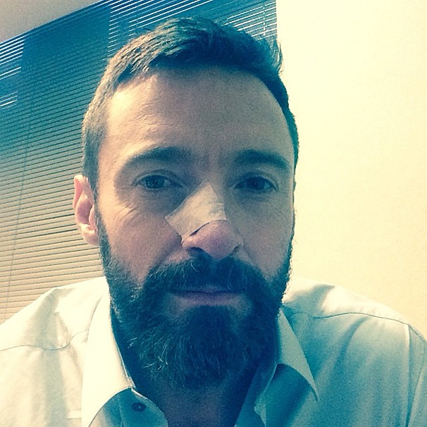 Tony Winner Hugh Jackman Undergoes Second Surgery to Remove Basal Cell Carcinoma