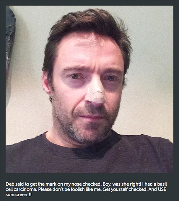 Ouch! Tony Winner Hugh Jackman Has Cancerous Cells Removed from Nose