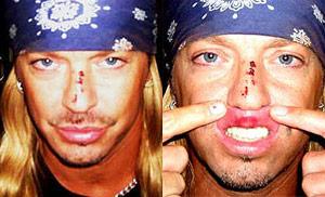 Bret Michaels Changes His Tune After Tony Night Injury