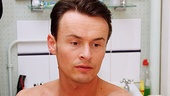 …that he covers with makeup before going on stage. 
